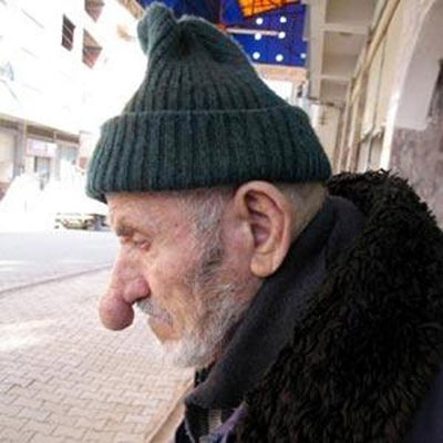 بینی دراز, درازترین بینی جهان, مسابقات درازی بینی