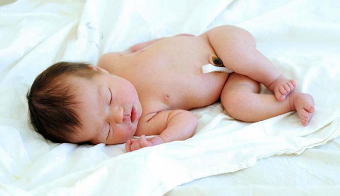 نحوه مراقبت از ناف و بند ناف نوزاد