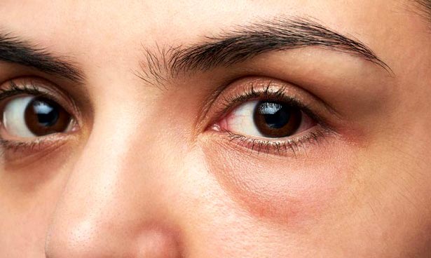 خط چشم برای چشمان پف دار
