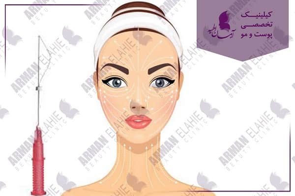 تاثیر رفع خط اخم بر چهره